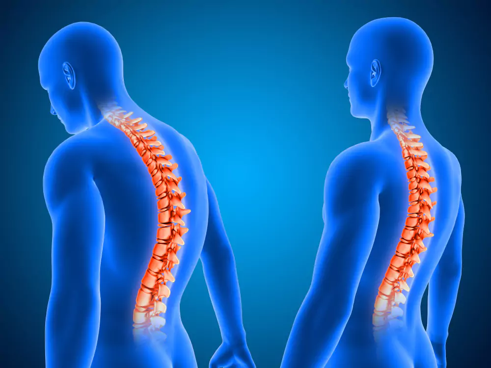 Neuro and Spine surgeries